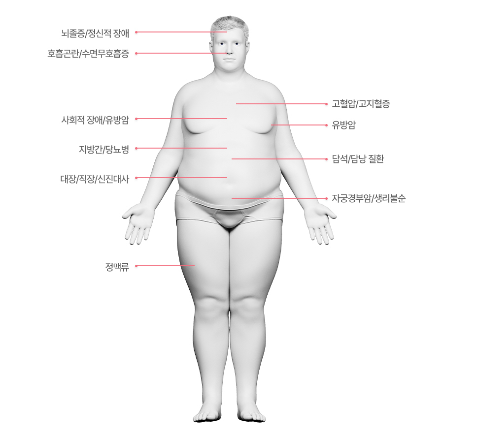 이미지명