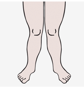 이미지명