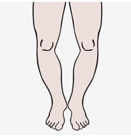 이미지명